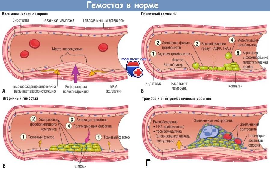 Гемостаз это. Виды гемостаза. Нормальный гемостаз. Гемостаз 9 показателей. 3. Гемостаз это.