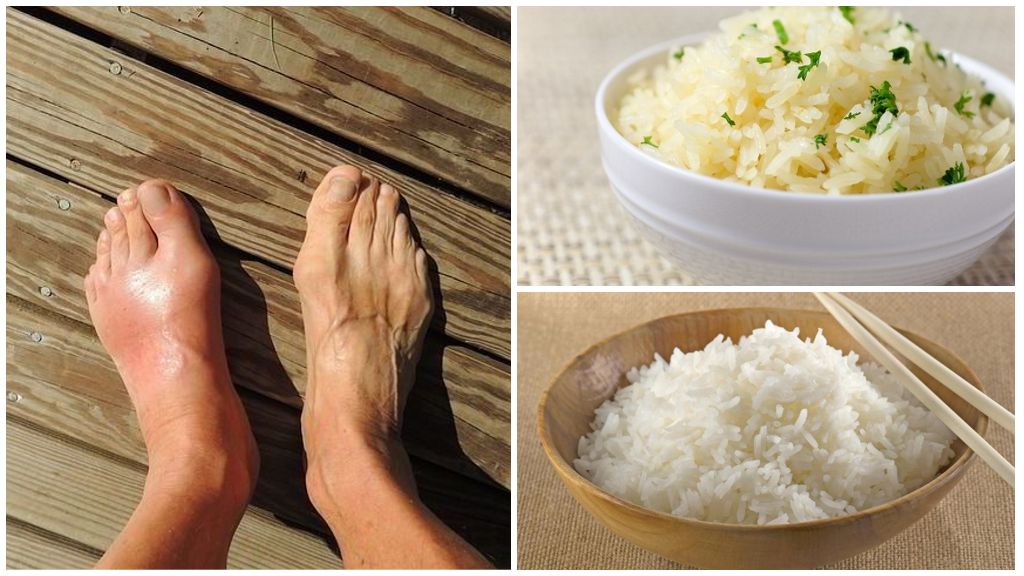 При подагре можно есть соленое. Рисовая диета при подагре. Рисовая каша при подагре.